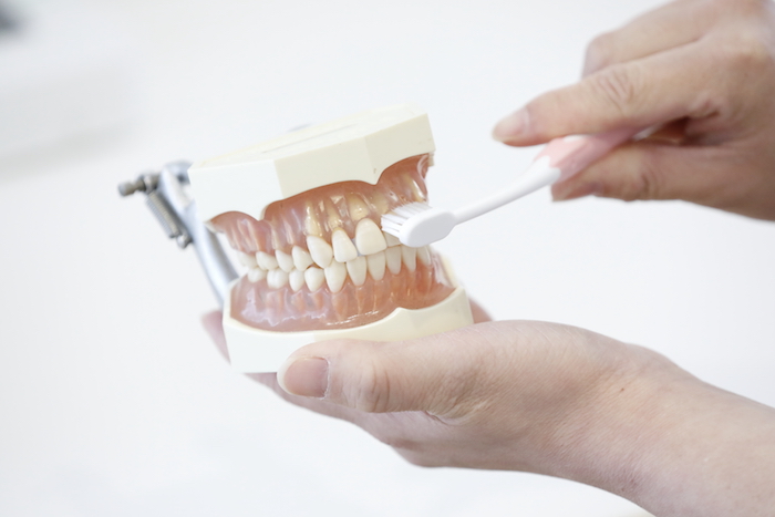 予防治療のための歯磨き指導