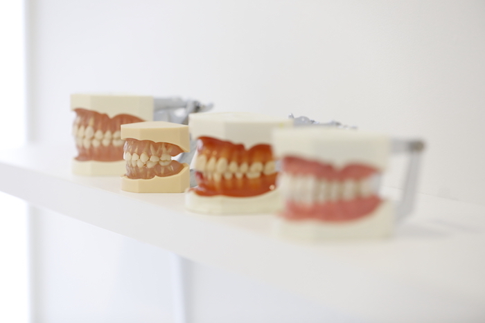 矯正歯科歯の模型